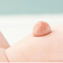 Эмбриональные грыжи: как лечить грыжу у ребенка?